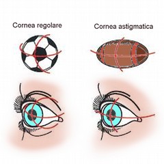 L’astigmatismo non corretto può provocare stanchezza e mal di testa