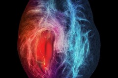 Settimana Mondiale del Cervello: iniziativa del Centro Diurno “REM” per non autosufficienti di Andria