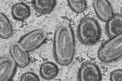 Vaiolo delle scimmie: primo caso scoperto nella Bat. Un giovane si è recato al "Dimiccoli" con alcuni sintomi