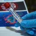 Covid in Puglia, risale il numero degli attualmente positivi