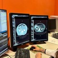 "Screening mammario gratis a tutte le donne dai 45 ai 74 anni "