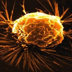 Il “driver” del cancro