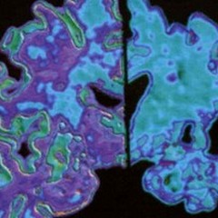 La proteina nemica dei neuroni