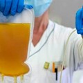 Covid-19 e donazione plasma: «Un'organizzazione da potenziare»