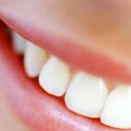 Prevenzione tumore del cavo orale, screening gratuito al  "Dimiccoli " di Barletta