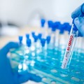 Meno di 800 positivi ricoverati in Puglia