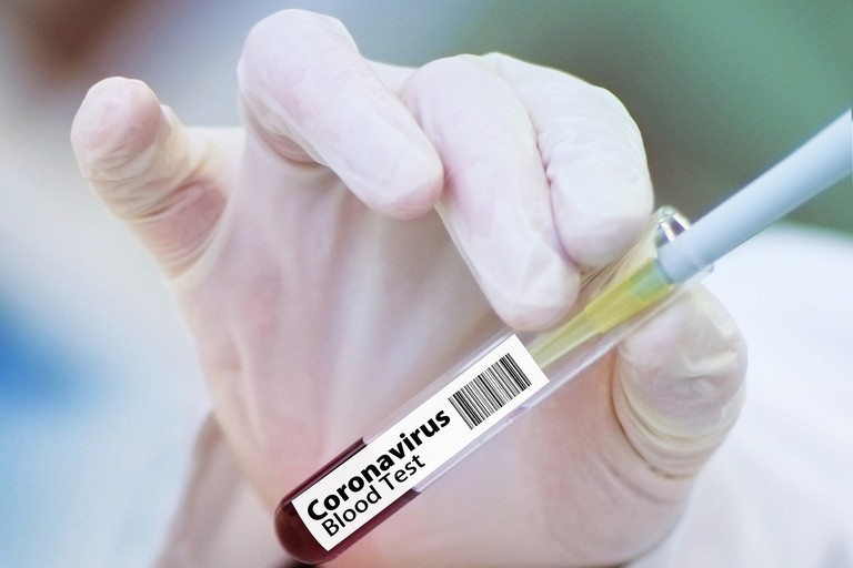 Tampone coronavirus