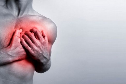 cardiopatia infarto